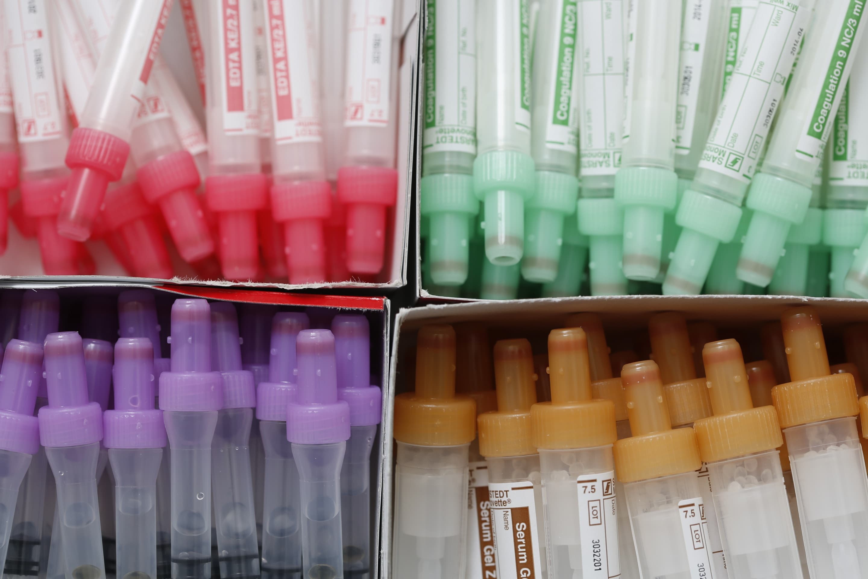Laborröhrchen für Blutentnahme — Symbolbild für Labordiagnostik